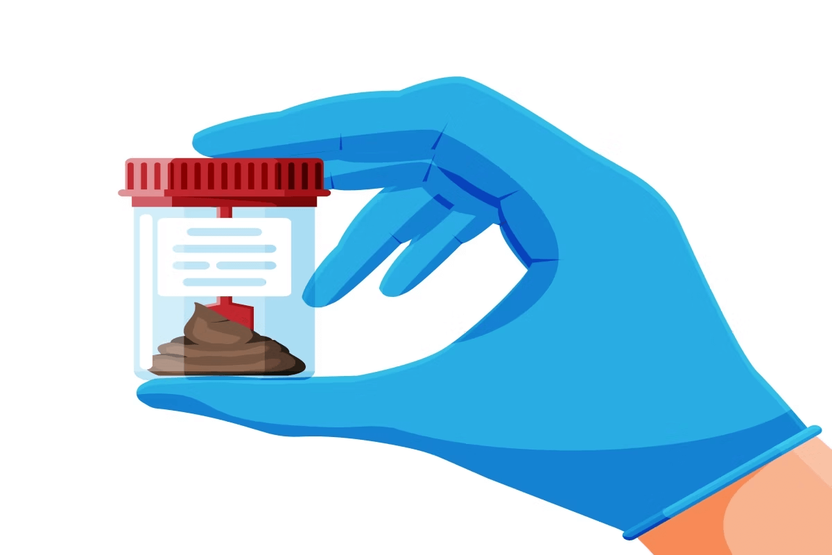 Se há muco ou catarro nas fezes, é importante buscar um diagnóstico. Seu médico poderá solicitar exames de fezes, de sangue ou de imagem (como raio-x, ultrassonografia e outros). O importante é buscar ajuda caso encontre catarro nas fezes.